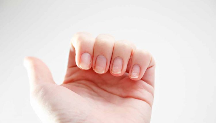 Preventing Nail Abnormalities